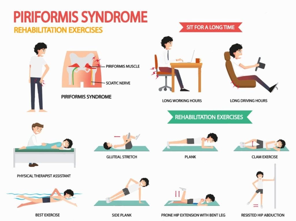 piriformis syndrome treatment wellness doctor rx el paso tx.