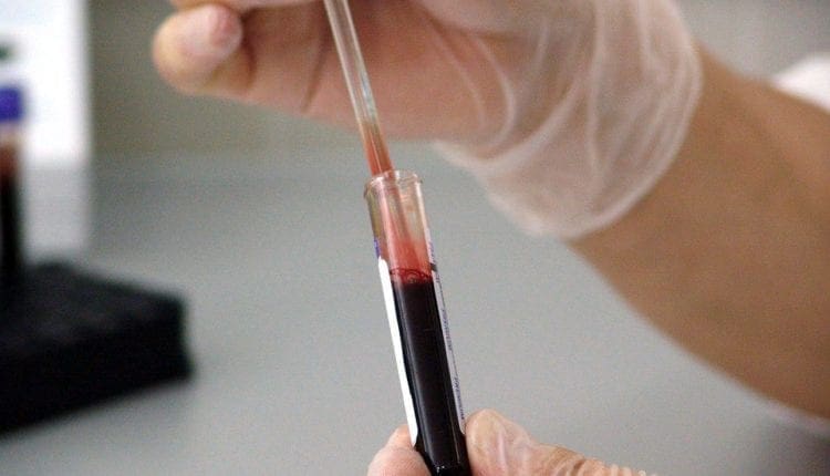 Integrative PRP Science in Musculoskeletal Healing