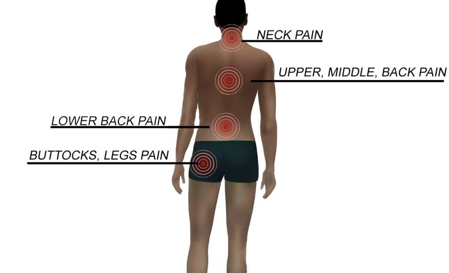 Acute Pain, Chronic Pain, and Neuropathic Pain
