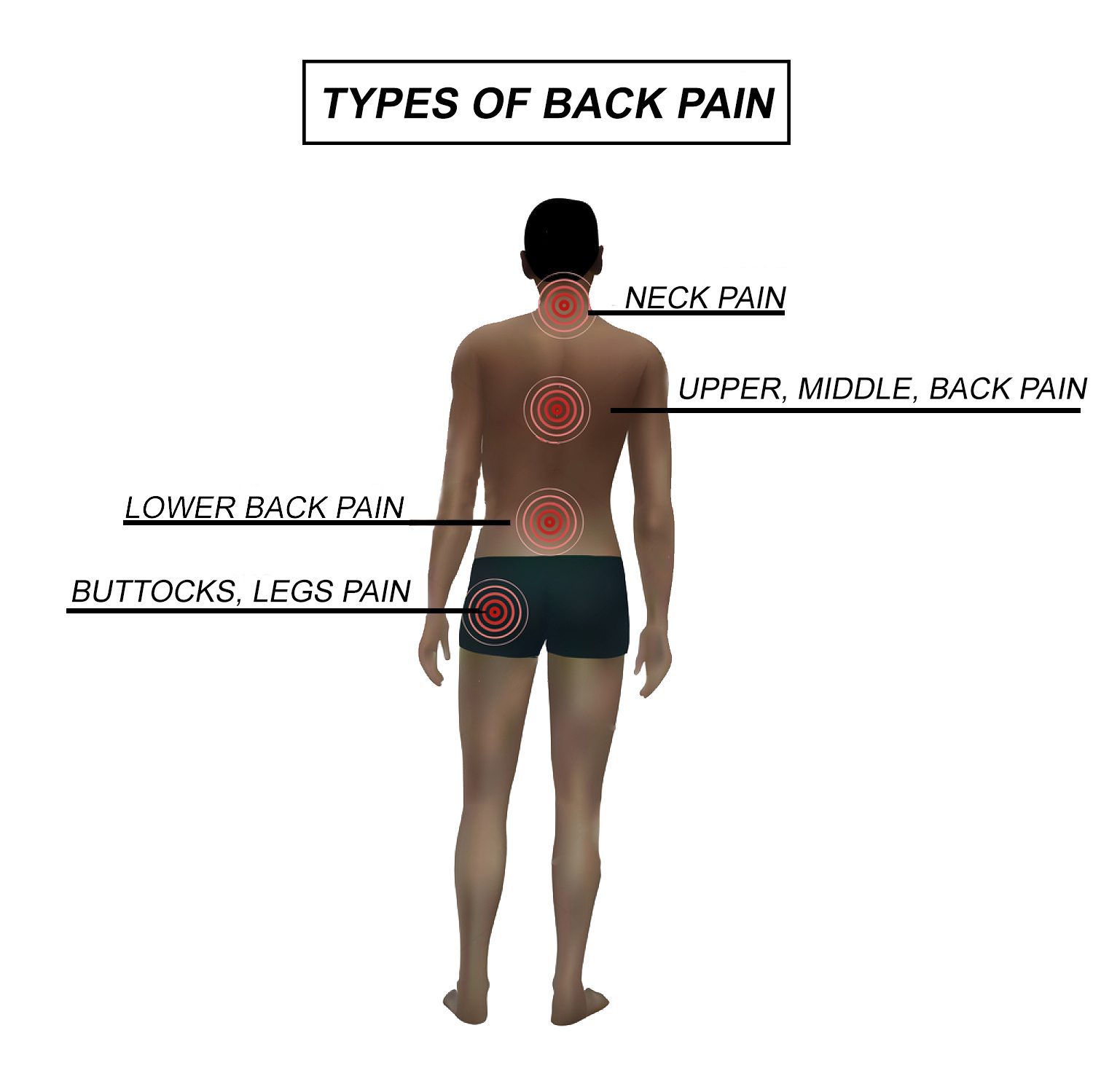 Acute Pain, Chronic Pain, and Neuropathic Pain