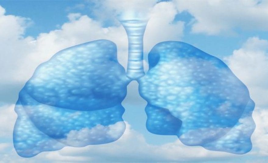 blog illustration of lungs in the sky