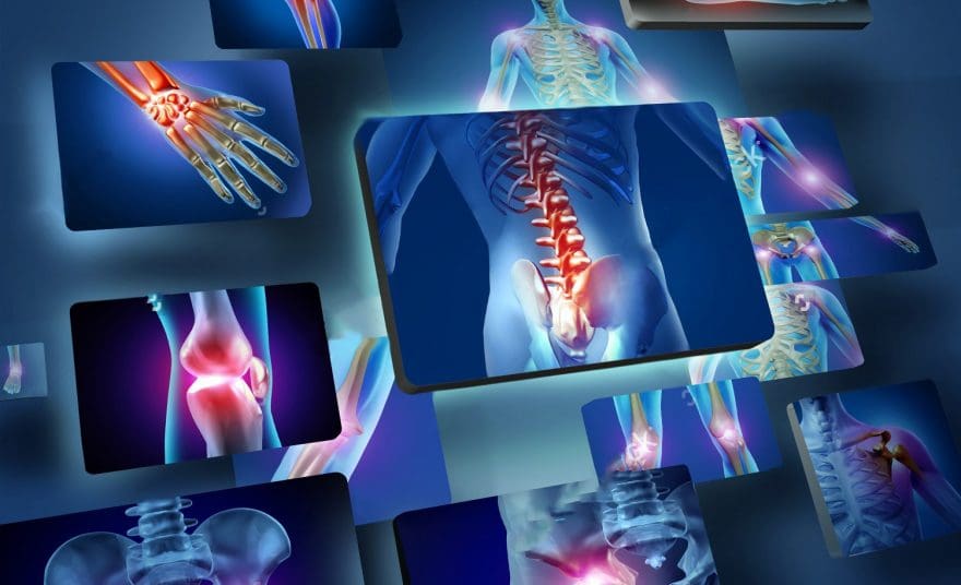 blog picture of various areas where arthritis can hit