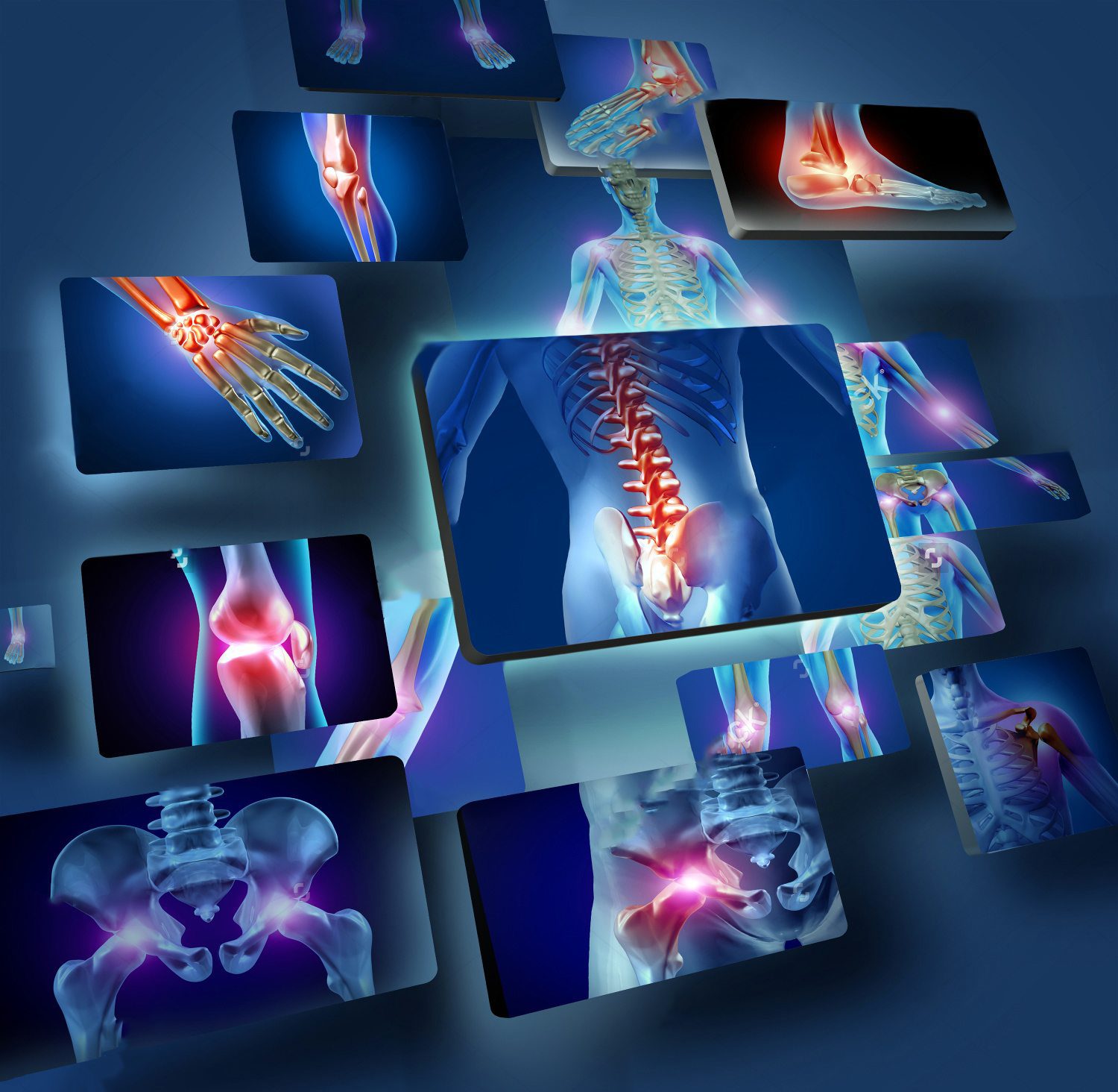 blog picture of various areas where arthritis can hit
