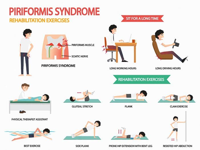 relieve illustrations of various exercises for piriformis syndrome