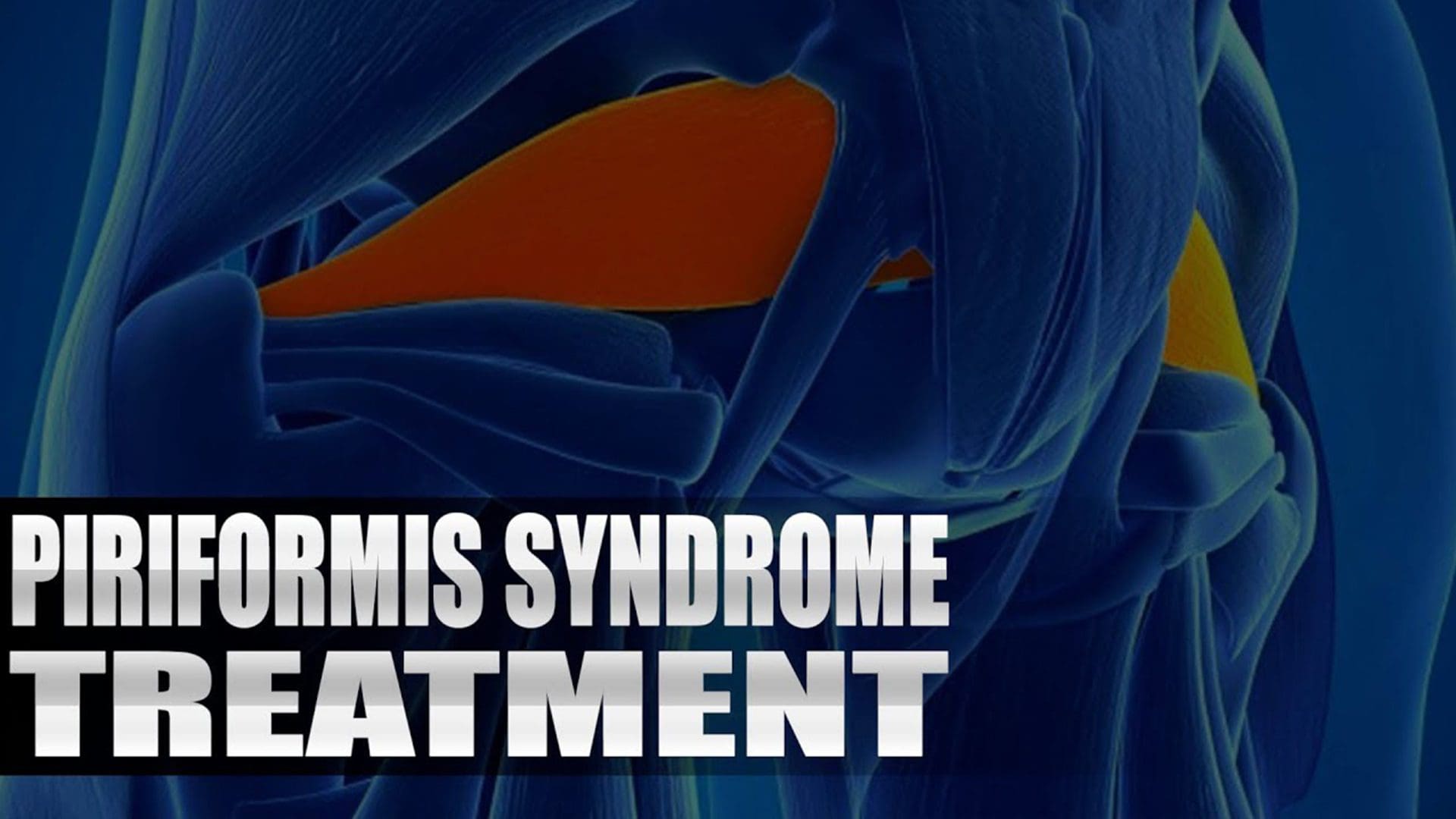 piriformis syndrome treatment el paso tx.