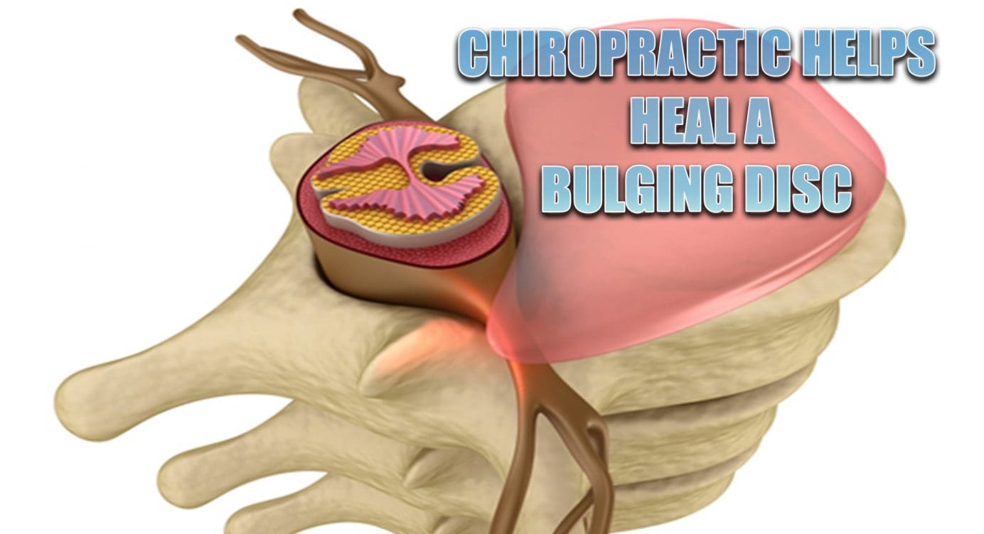 Heal A Bulging Disc Through Chiropractic | El Paso, TX.