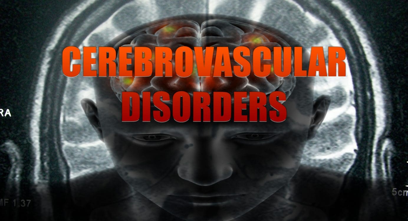 Cerebrovascular Disorders