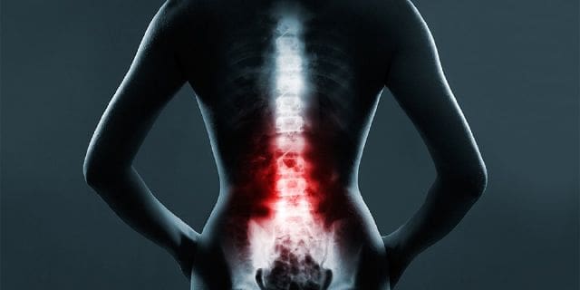 The Role of Emergency Radiology in Spinal Trauma | El Paso, TX Chiropractor