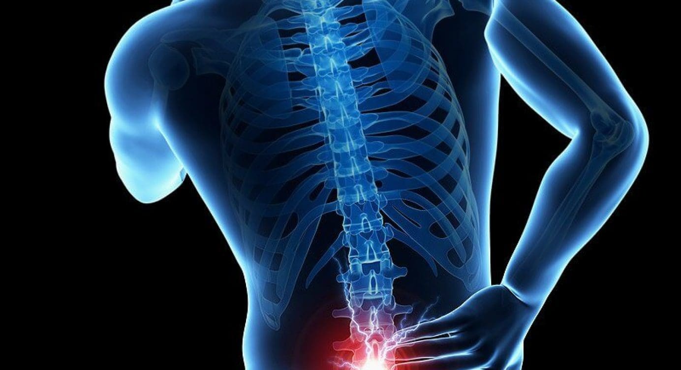 Lumbar Disc Nomenclature: Version 2.0