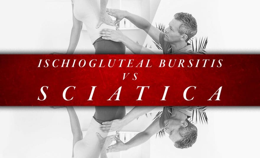 Ischiogluteal Bursitis vs Sciatica | El Paso, TX Chiropractor