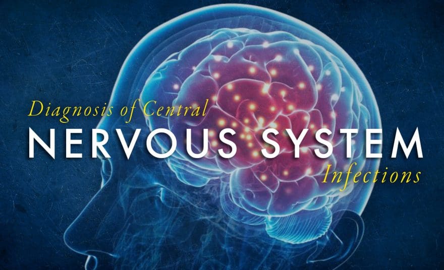 Diagnosis of Central Nervous System Infections Part 1 | El Paso, TX Chiropractor