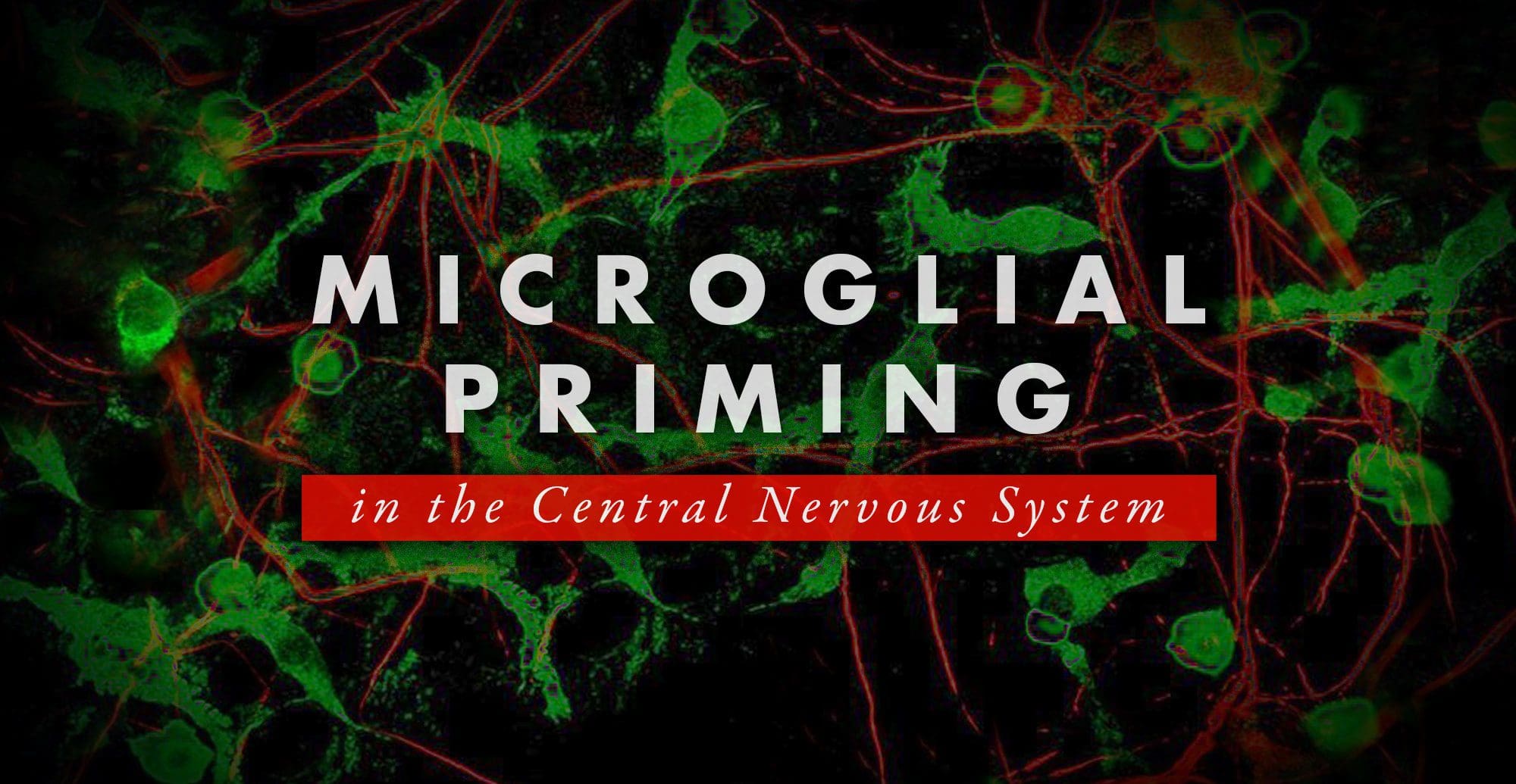 Microglial Priming in the Central Nervous System | El Paso, TX Chiropractor