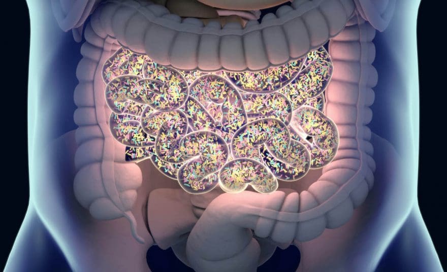 Image showing SIBO or small intestinal bacterial overgrowth.