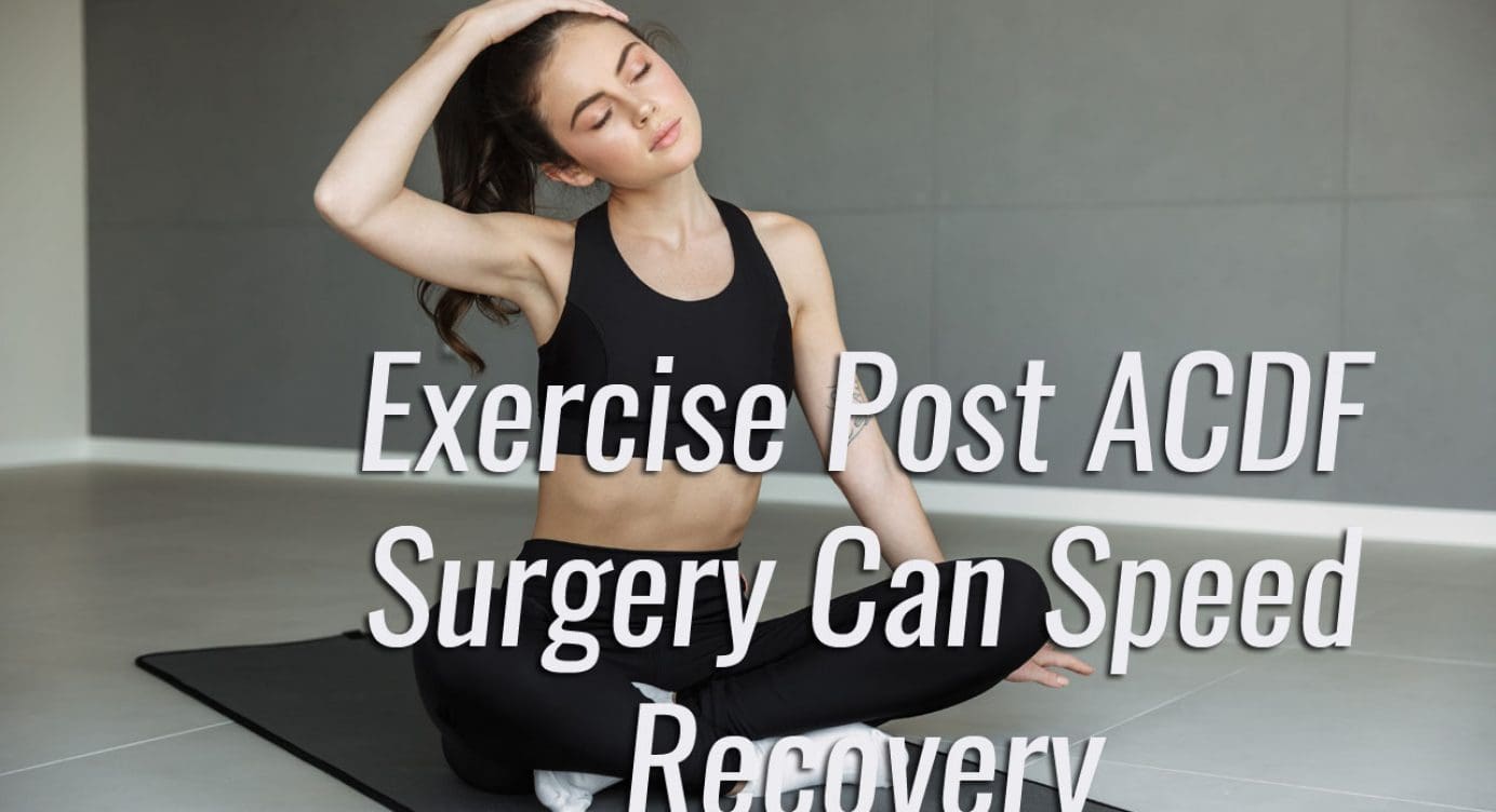 Exercise Can Speed Recovery From ACDF Surgery El Paso, Texas