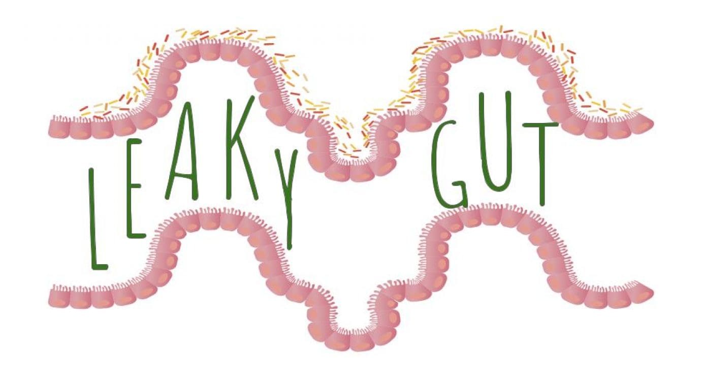 “Leaky Gut” – What Does It Really Mean?
