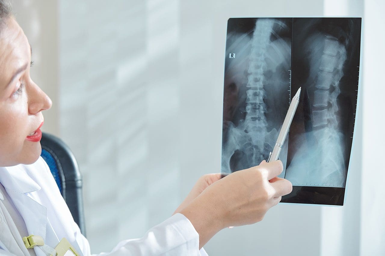11860 Vista Del Sol, Ste. 128 Exactly What Is Minimally Invasive Spine Surgery?
