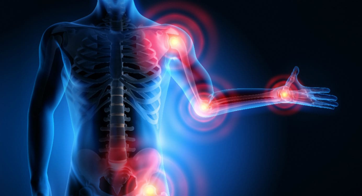 Musculoskeletal System and Oxidative Stress