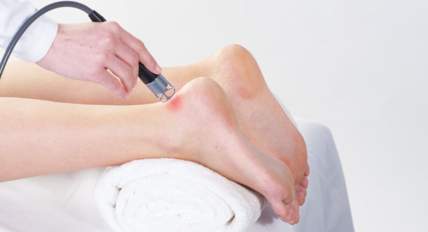 The Effects of Low Laser Therapy on Repairing The Calcaneal Tendon | El Paso, TX