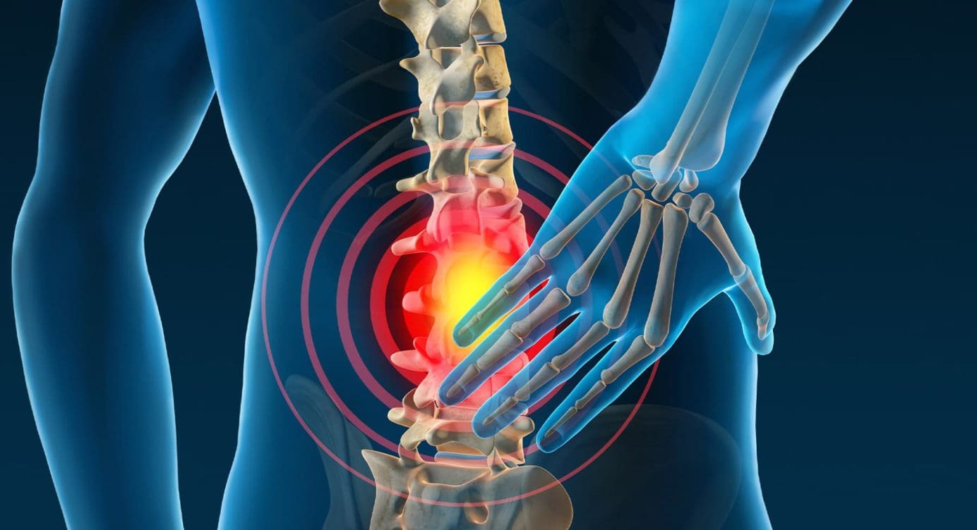 The Effects Of Spinal Decompression For Lumbar Disc Herniation