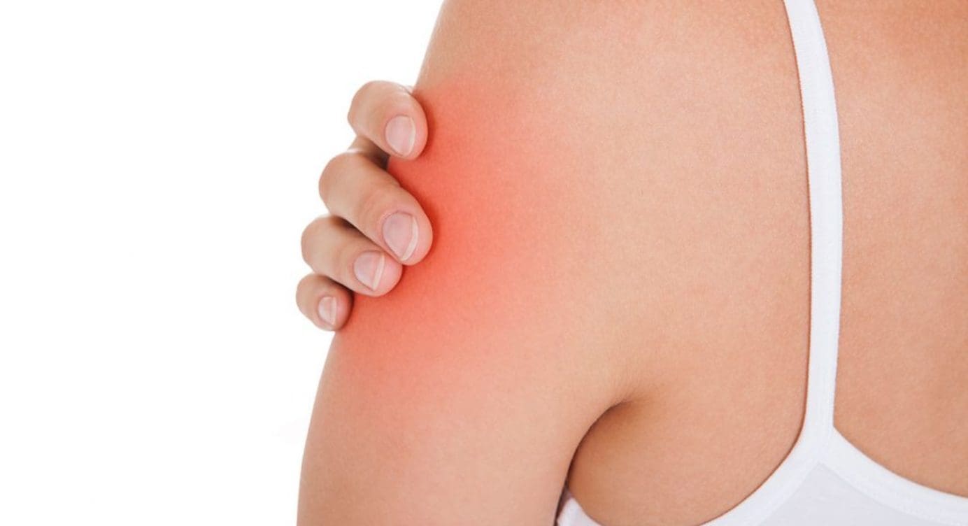 Trigger Points Affecting The Upper Arm Muscles