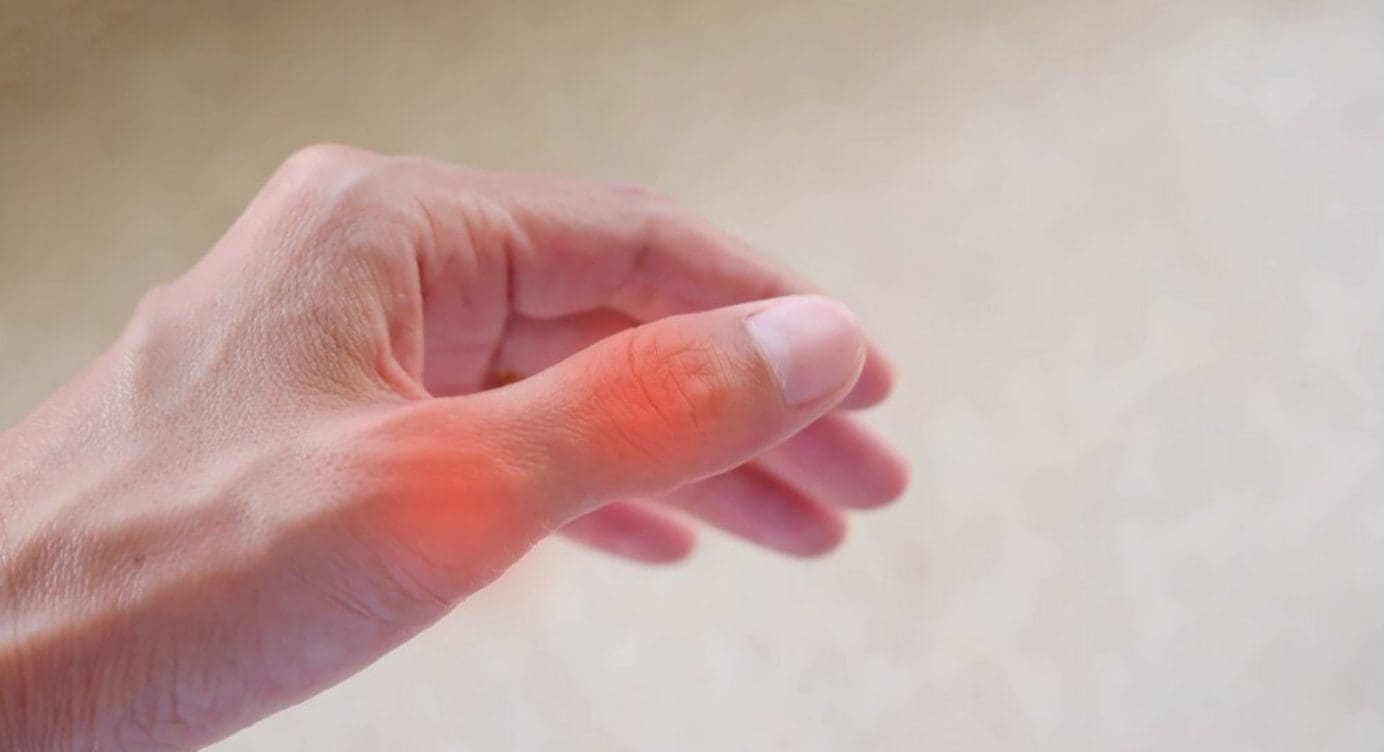 Myofascial Trigger Pain Affecting The Thumb Muscles