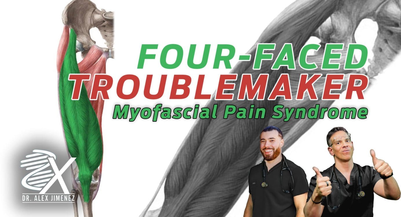Myofascial Pain Syndrome Affecting The Quadriceps Femoris