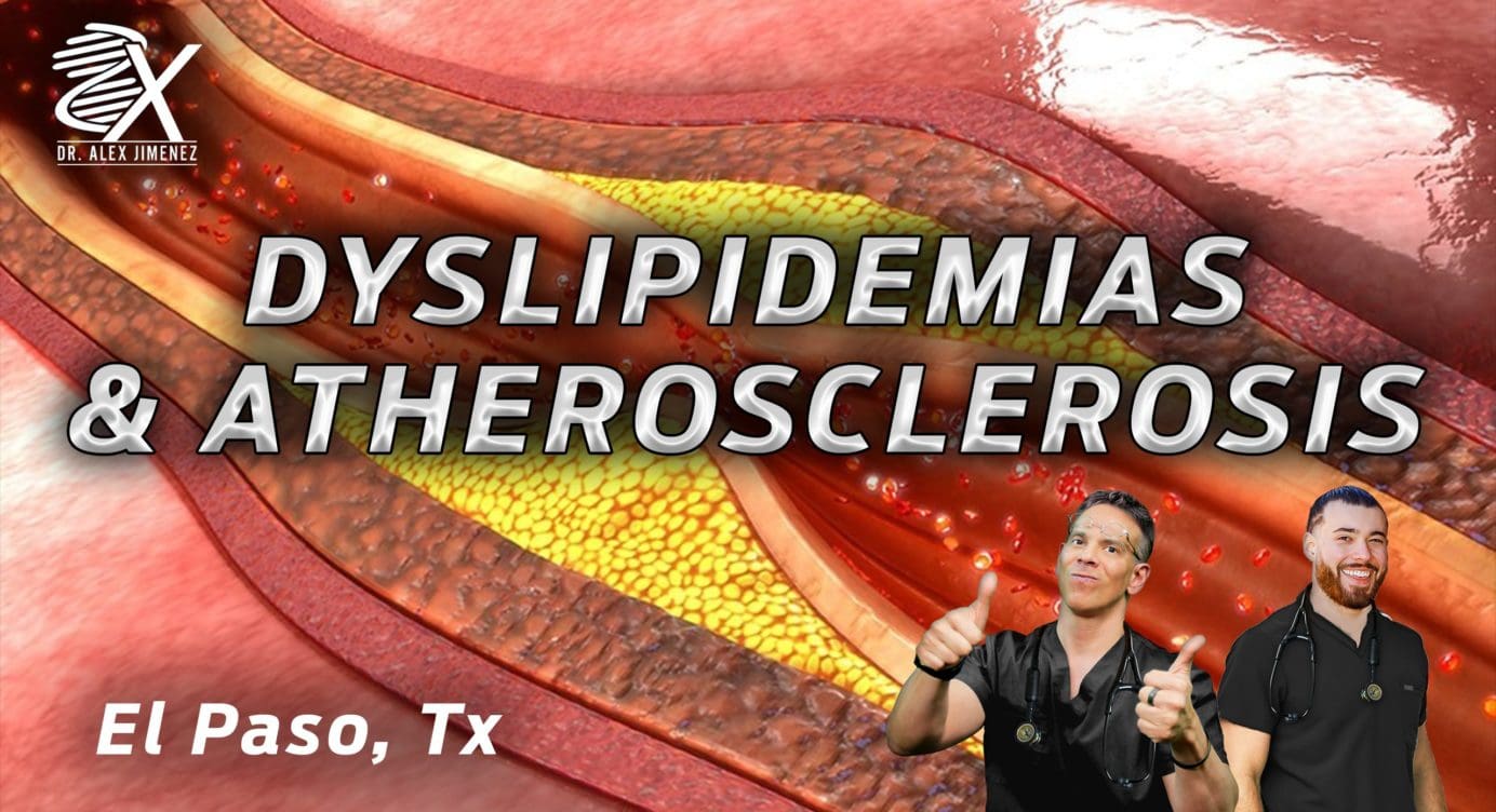Dr. Alex Jimenez Presents: Preventing Atherosclerosis With Chiropractic Care