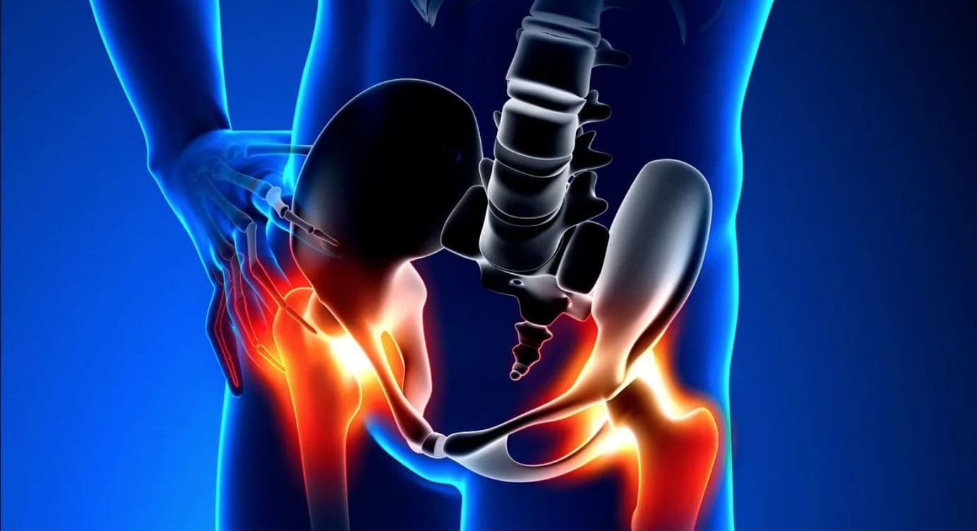 Assessing Hip Flexors With MET Therapy