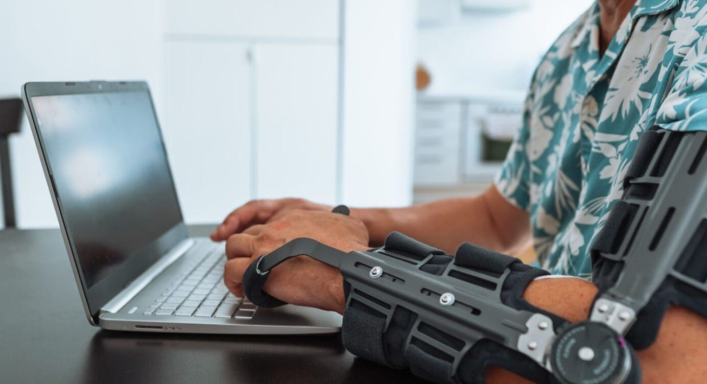 Recovering from Elbow Dislocation – Step-by-Step Guide