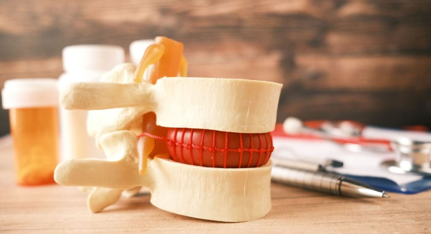 Maintaining Intervertebral Disc Health: Tips for a Strong Spine
