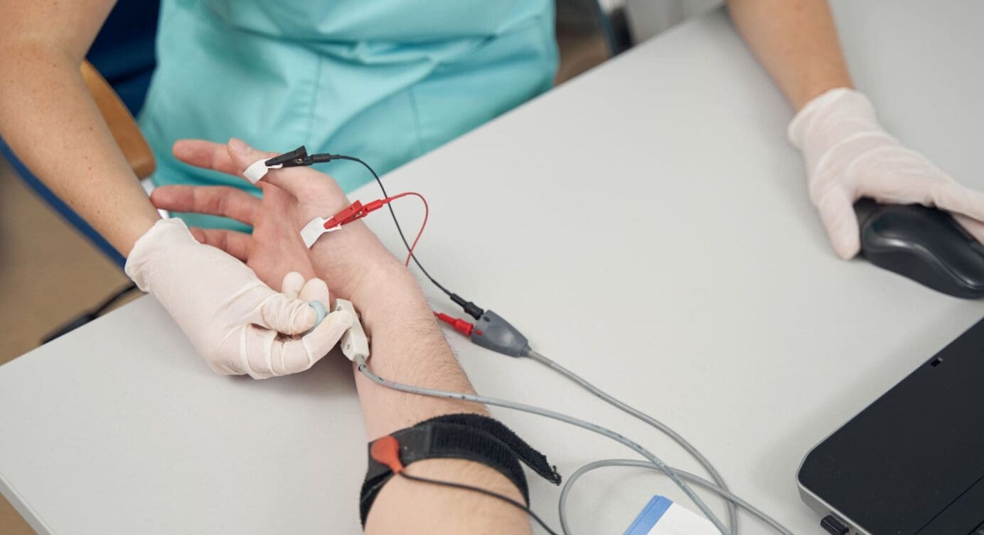 Nerve Conduction Velocity in Diagnosing Nerve Issues