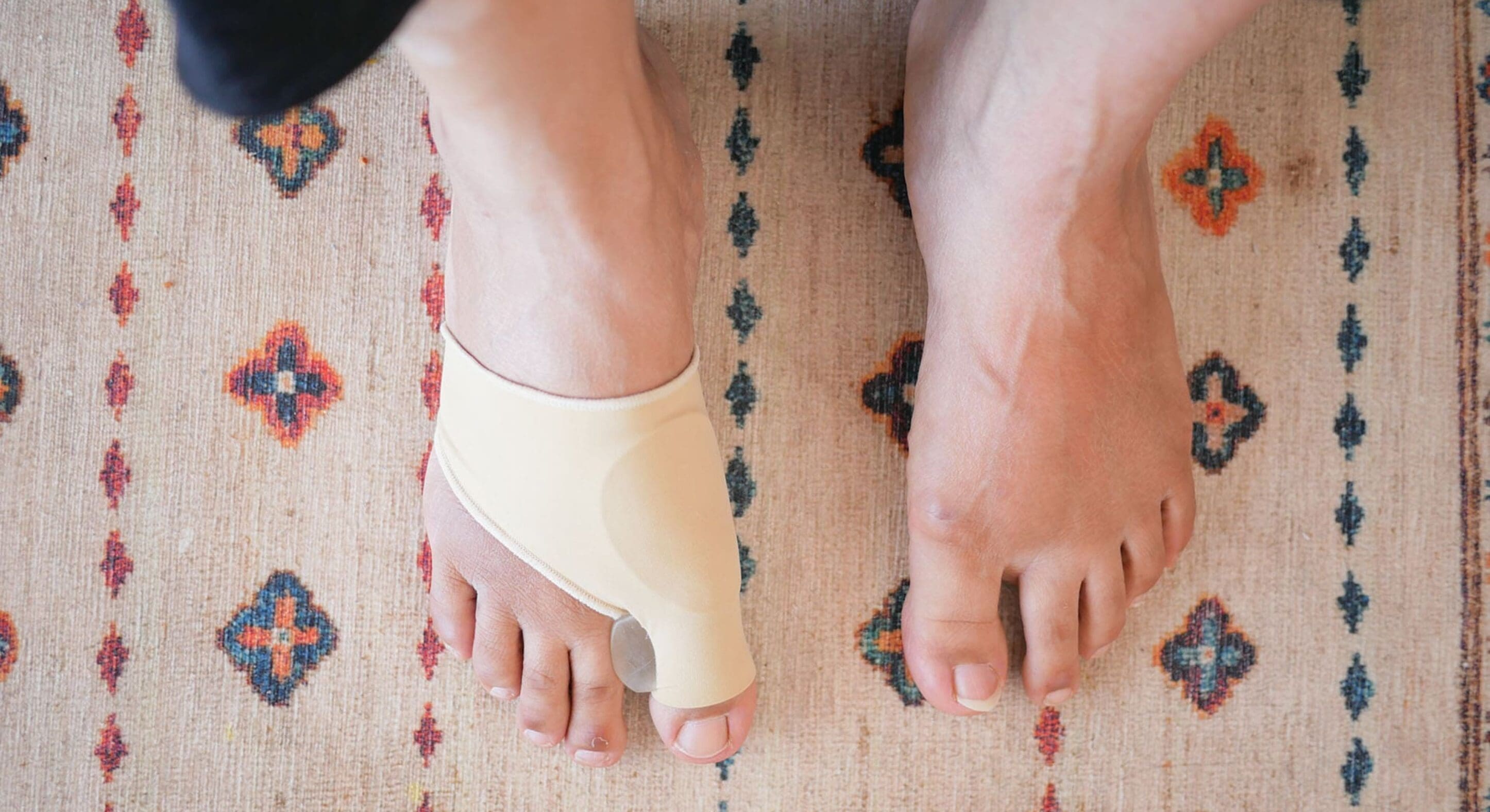 Bunions: Early Signs and Pain Relief Solutions