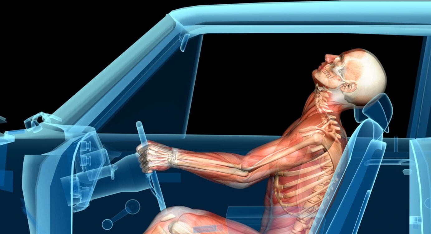 Auto Accidents Recovery for Whiplash and Achilles Tendinosis