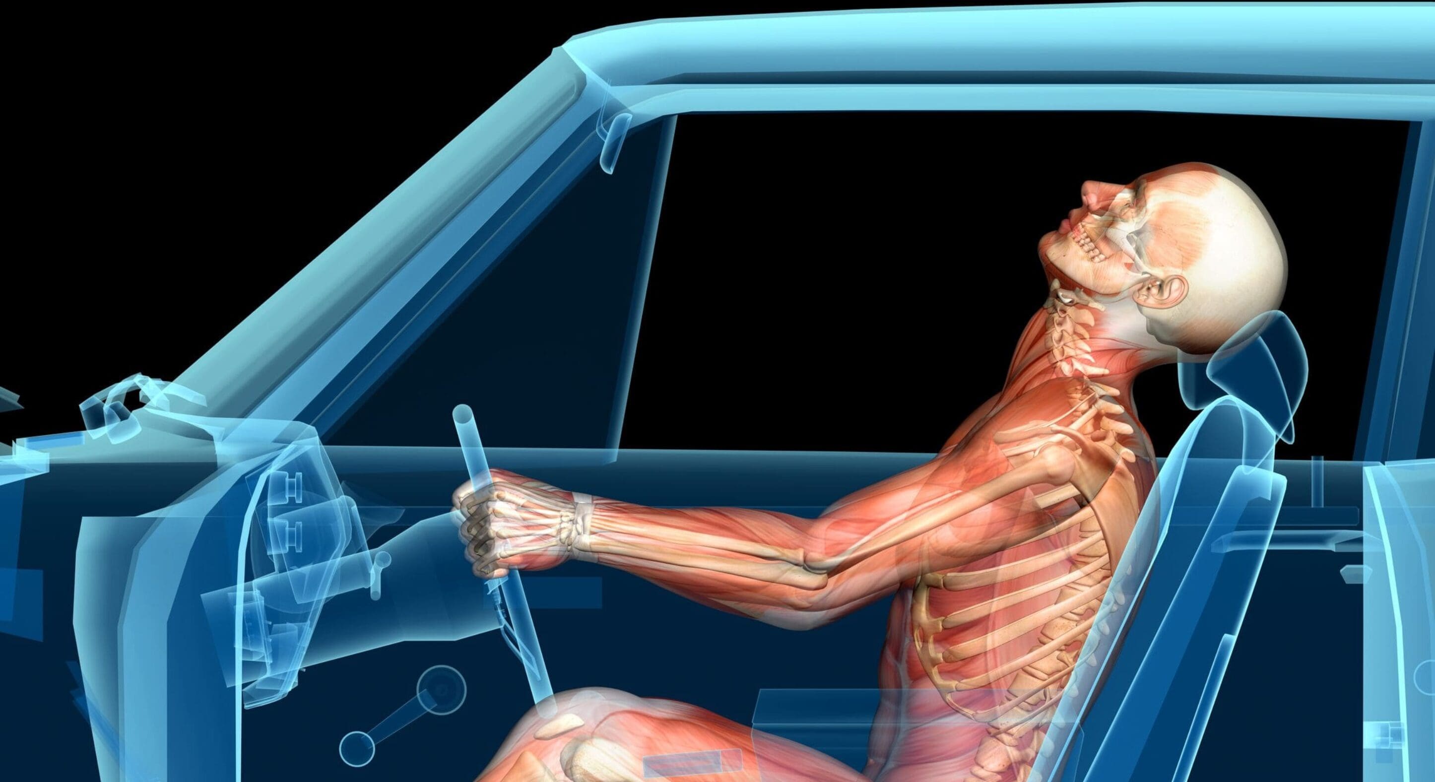 Auto Accidents Recovery for Whiplash and Achilles Tendinosis